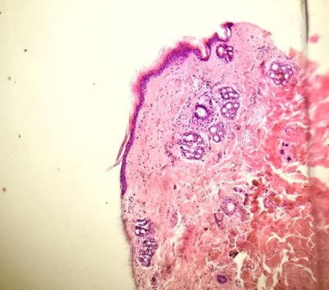 Comparative Histological Changes to Investigate the Therapeutic Effect of Cefaclit+ Cream and Penicillin-Streptomycin on Wound Healing In Rabbits